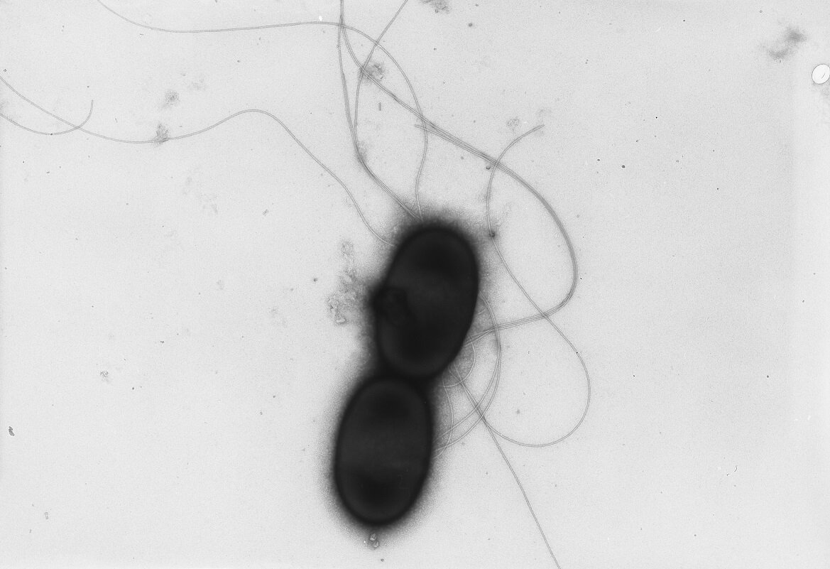 Liquorilactobacillus capillatusの透過型電子顕微鏡写真