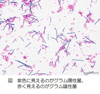 紫色に染まるグラム陽性菌と赤色に染まるグラム陰性菌（引用：健康用語の基礎知識-ヤクルト中央研究所）