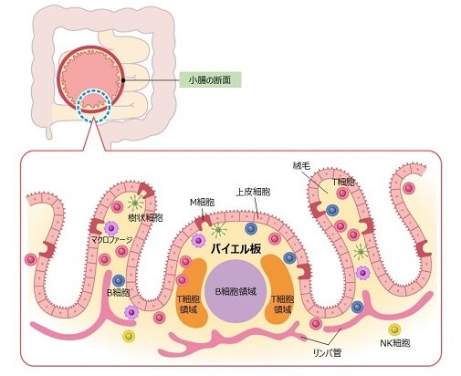 上皮内リンパ球増加症はどのように診断されますか?