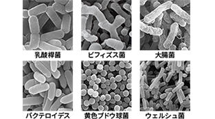 健腸長寿③:腸のミクロの住人たち