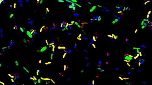 糞便中の細菌の多重染色画像
